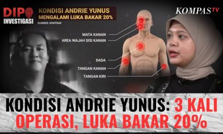 Kisah Andrie Yunus: 3 Pekan Melawan Luka Usai Disiram Air Keras