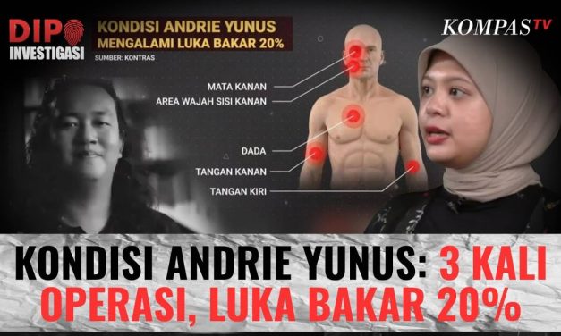Kisah Andrie Yunus: 3 Pekan Melawan Luka Usai Disiram Air Keras